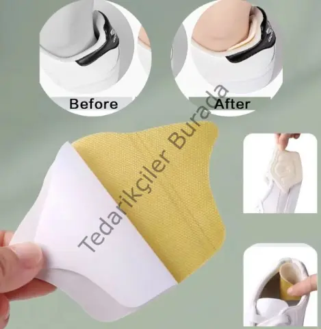 Taç Şekilli 5 Mm Topuk Daraltma Ve Vurma Önleyici Bx40